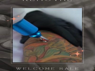 Unlock the Future of Skincare at Benjamin Boutique: Laser Tattoo Removal services